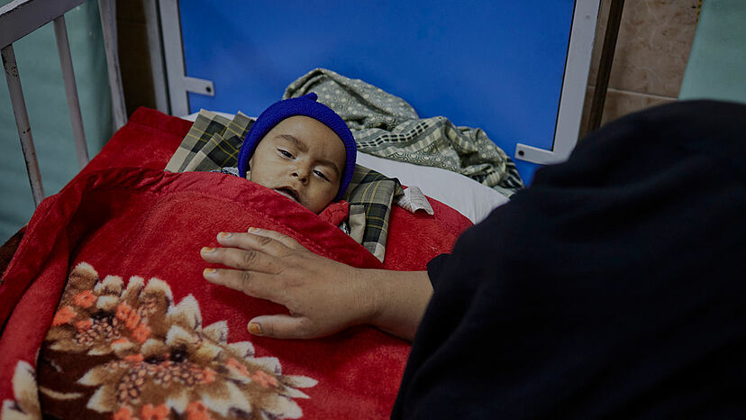 Der 8 Monate alte Barkatullah wird im Kinderkrankenhaus in Kabul wegen Mangelernährung behandelt.
Laut UNICEF sind rund 3,2 Millionen Kinder unter 5 Jahren in Afghanistan mangelernährt und 1,1 Millionen Kinder könnten an akuter Unterernährung sterben, wenn sie nicht behandelt werden.